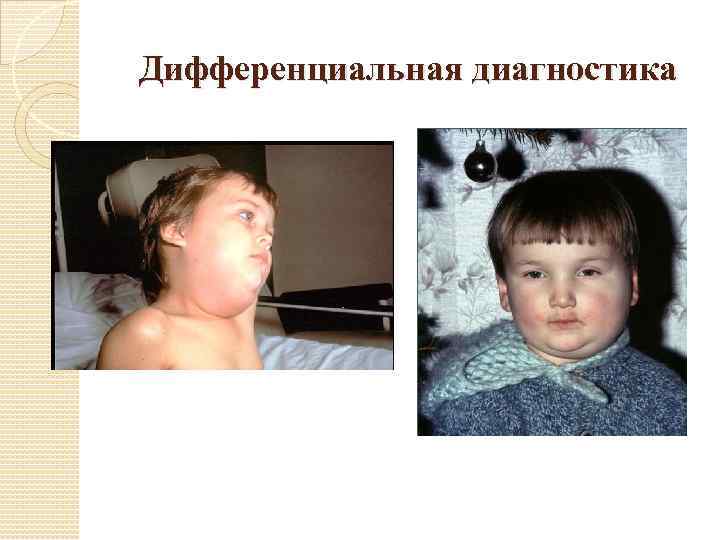 Дифференциальная диагностика 