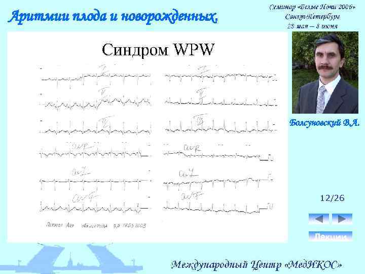 Аритмии плода и новорожденных. Болсуновский В. А. 12/26 Лекции 