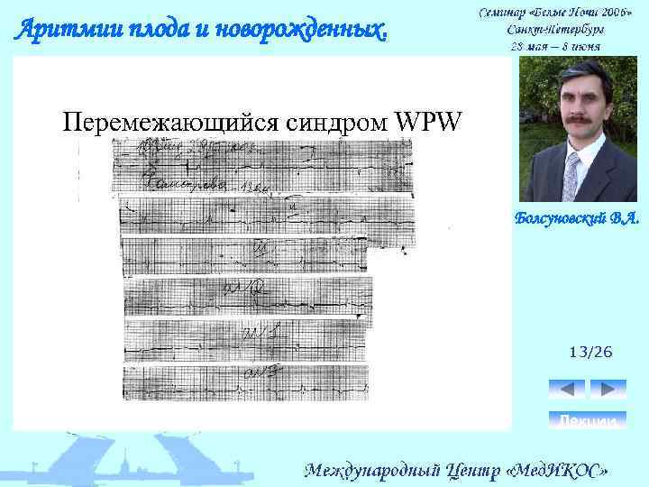 Аритмии плода и новорожденных. Болсуновский В. А. 13/26 Лекции 