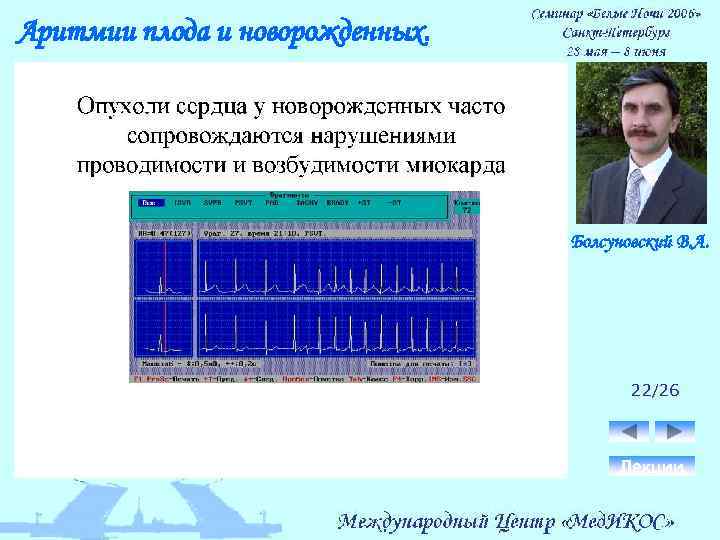 Аритмии плода и новорожденных. Болсуновский В. А. 22/26 Лекции 