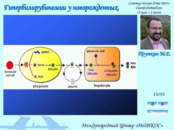 Гипербилирубинемии у новорожденных. Пруткин М. Е. 15/93 Лекции 