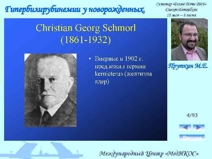 Гипербилирубинемии у новорожденных. Пруткин М. Е. 4/93 Лекции 