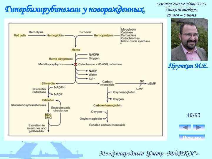 Гипербилирубинемии у новорожденных. Пруткин М. Е. 48/93 Лекции 