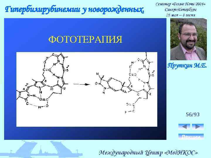 Гипербилирубинемии у новорожденных. Пруткин М. Е. 56/93 Лекции 