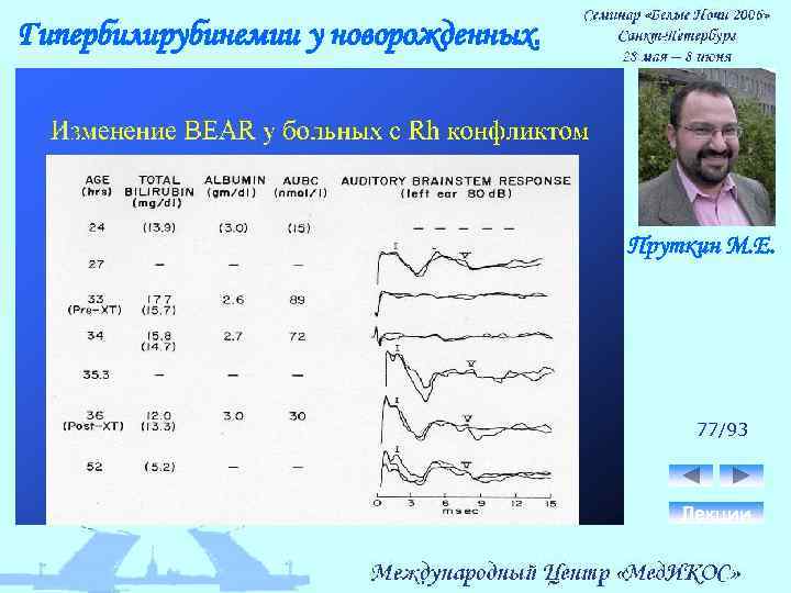 Гипербилирубинемии у новорожденных. Пруткин М. Е. 77/93 Лекции 
