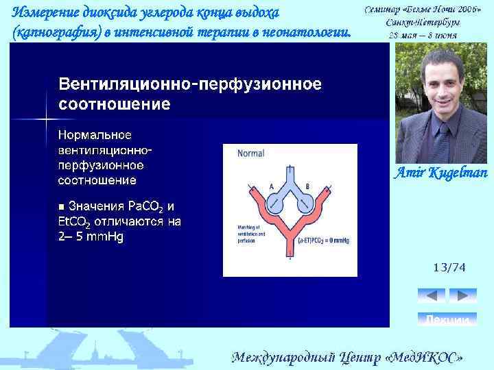 Измерение диоксида углерода конца выдоха (капнография) в интенсивной терапии в неонатологии. Amir Kugelman 13/74