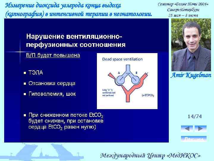 Измерение диоксида углерода конца выдоха (капнография) в интенсивной терапии в неонатологии. Amir Kugelman 14/74