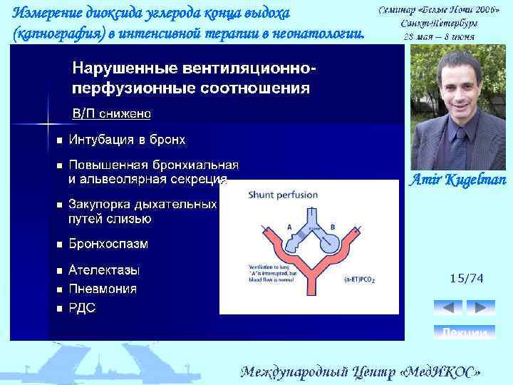 Измерение диоксида углерода конца выдоха (капнография) в интенсивной терапии в неонатологии. Amir Kugelman 15/74