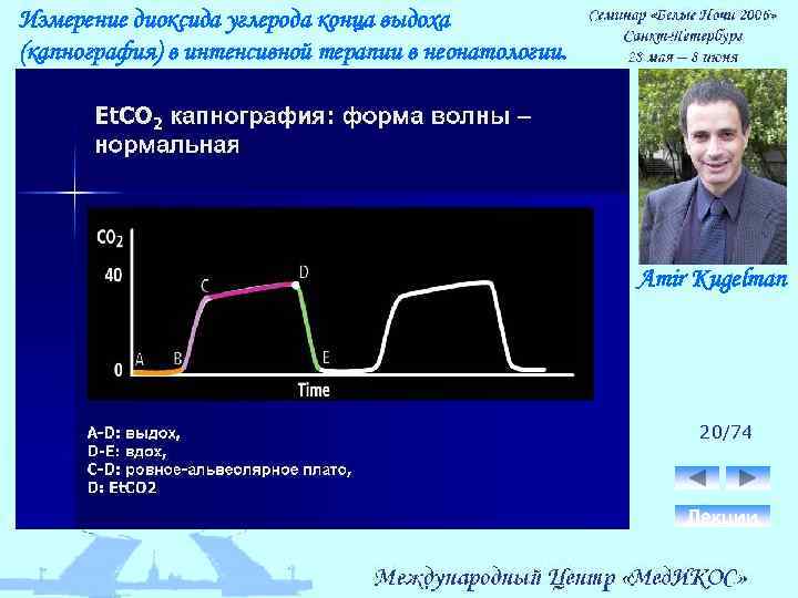 Измерение диоксида углерода конца выдоха (капнография) в интенсивной терапии в неонатологии. Amir Kugelman 20/74