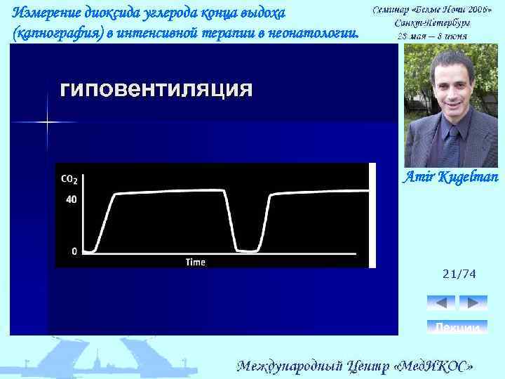 Измерение диоксида углерода конца выдоха (капнография) в интенсивной терапии в неонатологии. Amir Kugelman 21/74