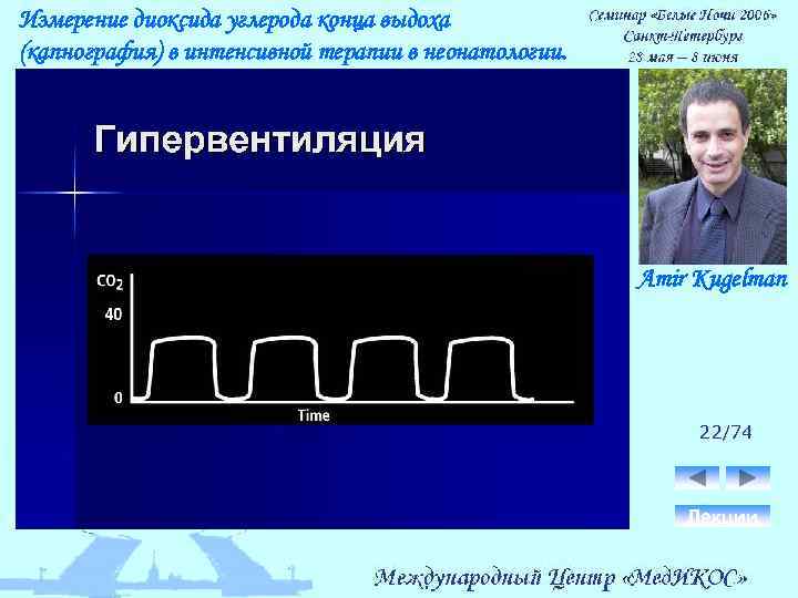 Измерение диоксида углерода конца выдоха (капнография) в интенсивной терапии в неонатологии. Amir Kugelman 22/74