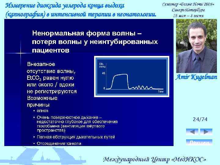 Измерение диоксида углерода конца выдоха (капнография) в интенсивной терапии в неонатологии. Amir Kugelman 24/74