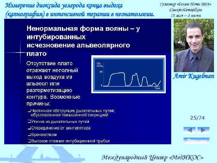 Измерение диоксида углерода конца выдоха (капнография) в интенсивной терапии в неонатологии. Amir Kugelman 25/74
