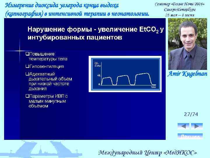 Измерение диоксида углерода конца выдоха (капнография) в интенсивной терапии в неонатологии. Amir Kugelman 27/74