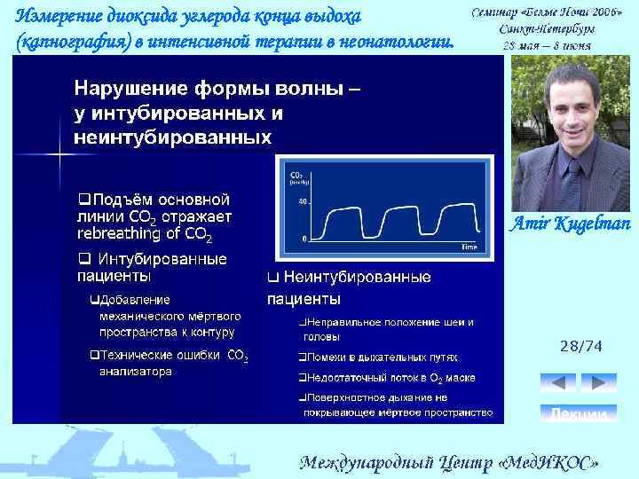 Измерение диоксида углерода конца выдоха (капнография) в интенсивной терапии в неонатологии. Amir Kugelman 28/74