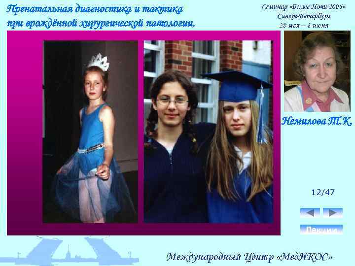 Пренатальная диагностика и тактика при врождённой хирургической патологии. Немилова Т. К. 12/47 Лекции 