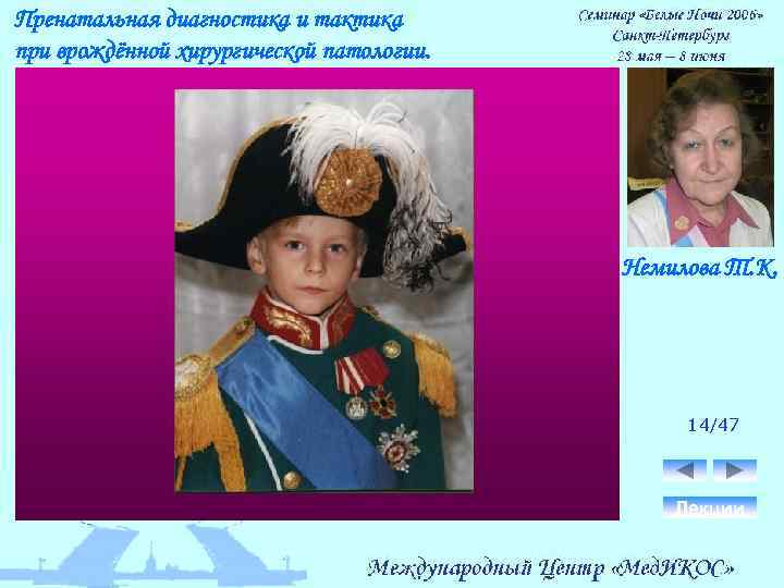 Пренатальная диагностика и тактика при врождённой хирургической патологии. Немилова Т. К. 14/47 Лекции 