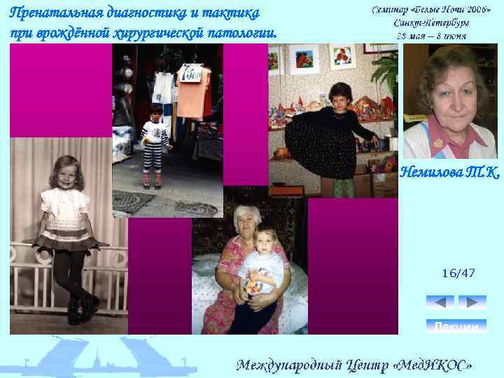 Пренатальная диагностика и тактика при врождённой хирургической патологии. Немилова Т. К. 16/47 Лекции 