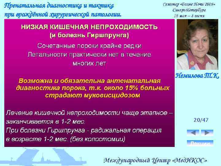 Пренатальная диагностика и тактика при врождённой хирургической патологии. Немилова Т. К. 20/47 Лекции 