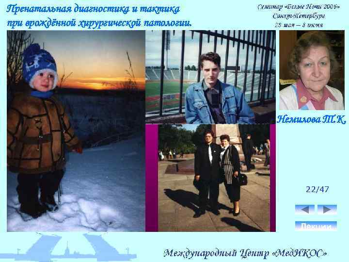 Пренатальная диагностика и тактика при врождённой хирургической патологии. Немилова Т. К. 22/47 Лекции 