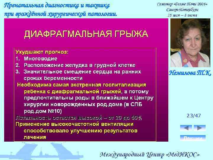 Пренатальная диагностика и тактика при врождённой хирургической патологии. Немилова Т. К. 23/47 Лекции 