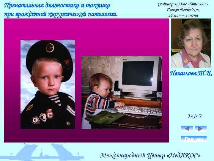 Пренатальная диагностика и тактика при врождённой хирургической патологии. Немилова Т. К. 24/47 Лекции 