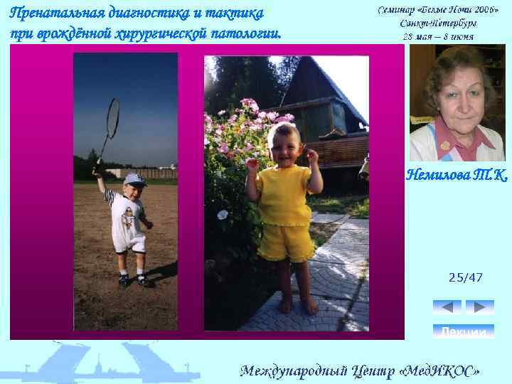 Пренатальная диагностика и тактика при врождённой хирургической патологии. Немилова Т. К. 25/47 Лекции 