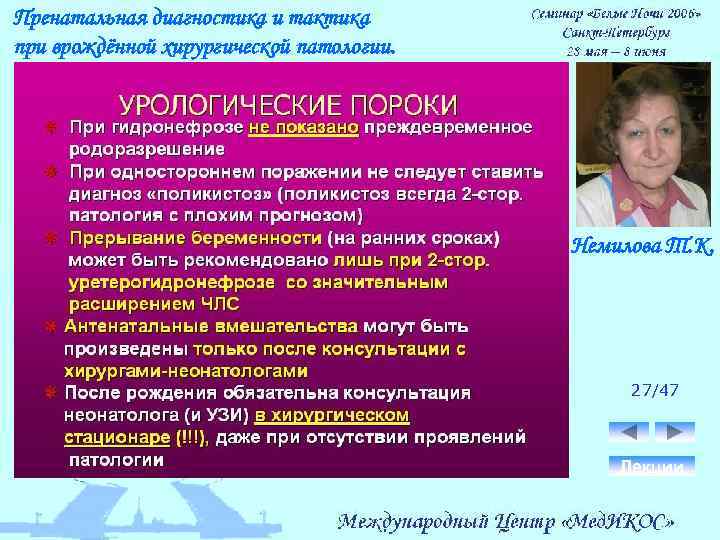 Пренатальная диагностика и тактика при врождённой хирургической патологии. Немилова Т. К. 27/47 Лекции 