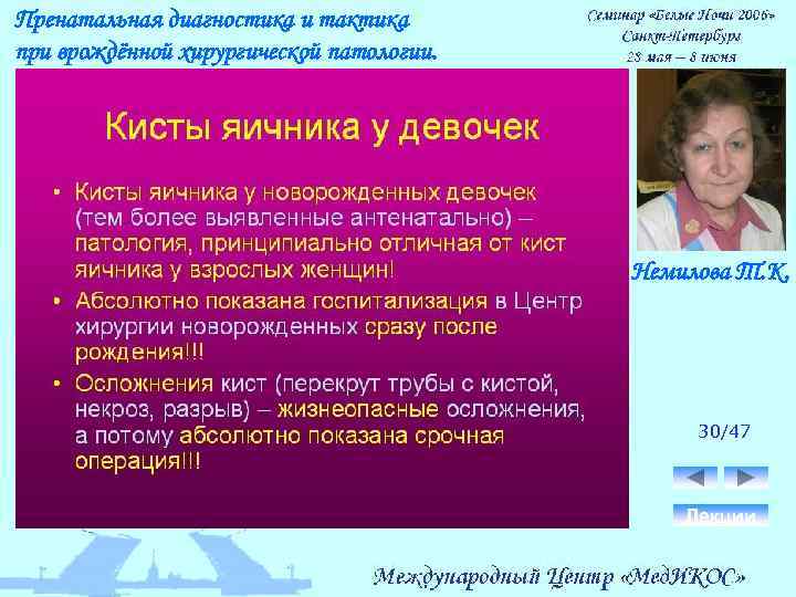 Пренатальная диагностика и тактика при врождённой хирургической патологии. Немилова Т. К. 30/47 Лекции 