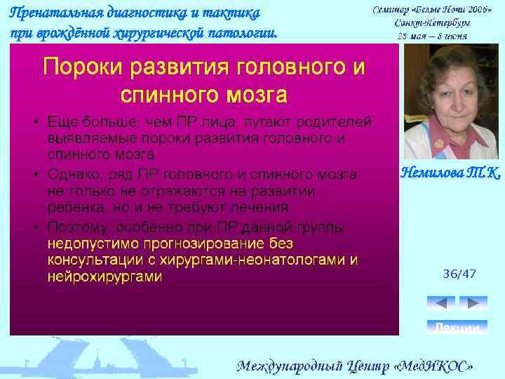 Пренатальная диагностика и тактика при врождённой хирургической патологии. Немилова Т. К. 36/47 Лекции 
