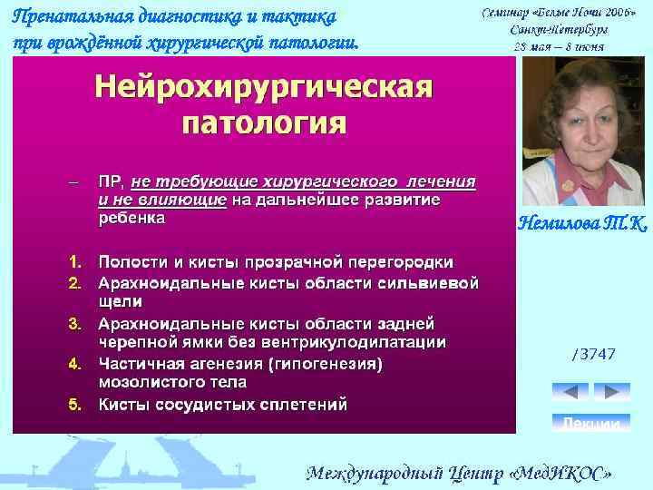 Пренатальная диагностика и тактика при врождённой хирургической патологии. Немилова Т. К. /3747 Лекции 