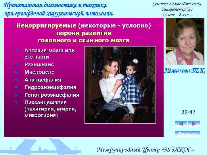 Пренатальная диагностика и тактика при врождённой хирургической патологии. Немилова Т. К. 39/47 Лекции 