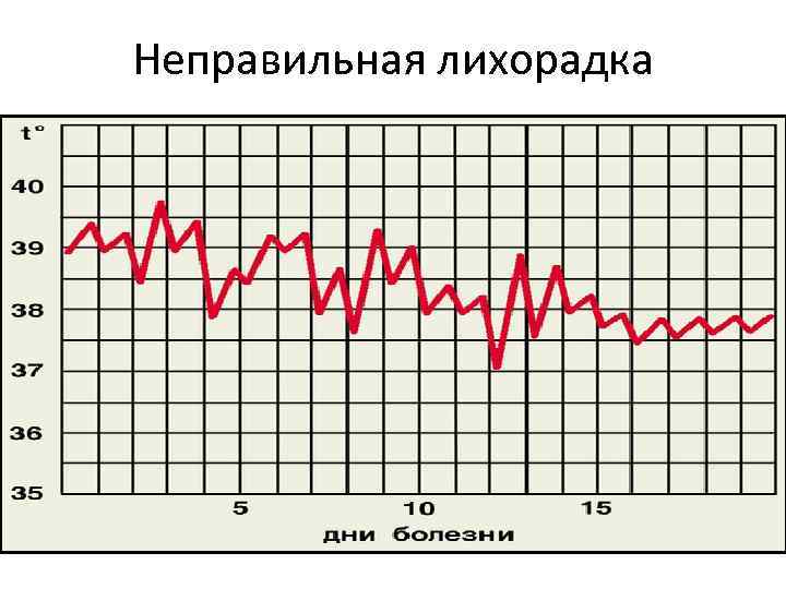 Неправильная лихорадка 