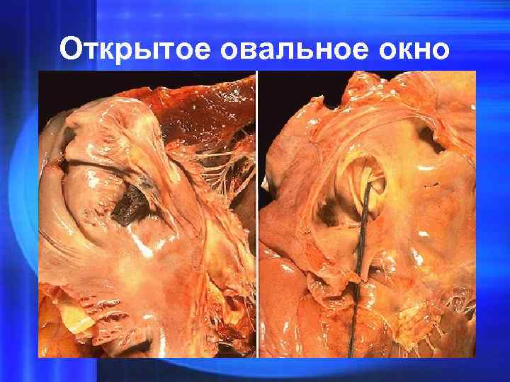 Открытое овальное окно 