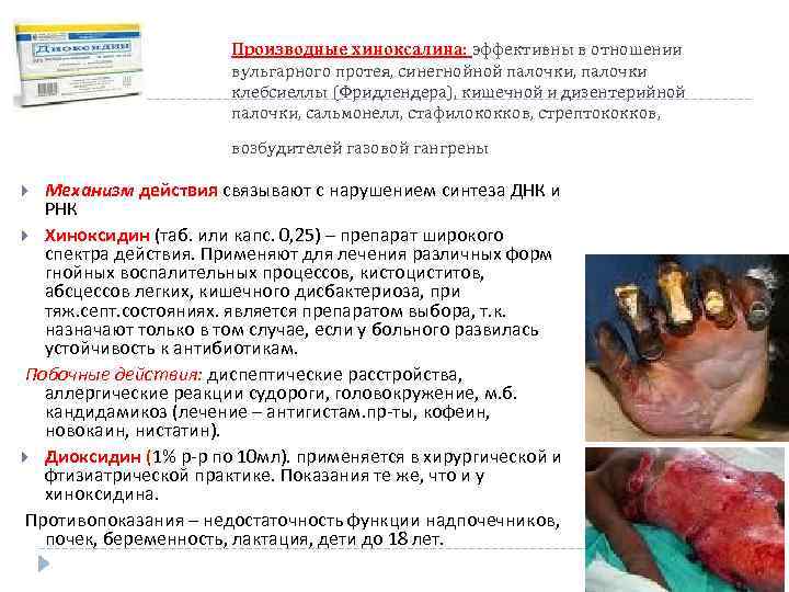 Производные хиноксалина: эффективны в отношении вульгарного протея, синегнойной палочки, палочки клебсиеллы (Фридлендера), кишечной и