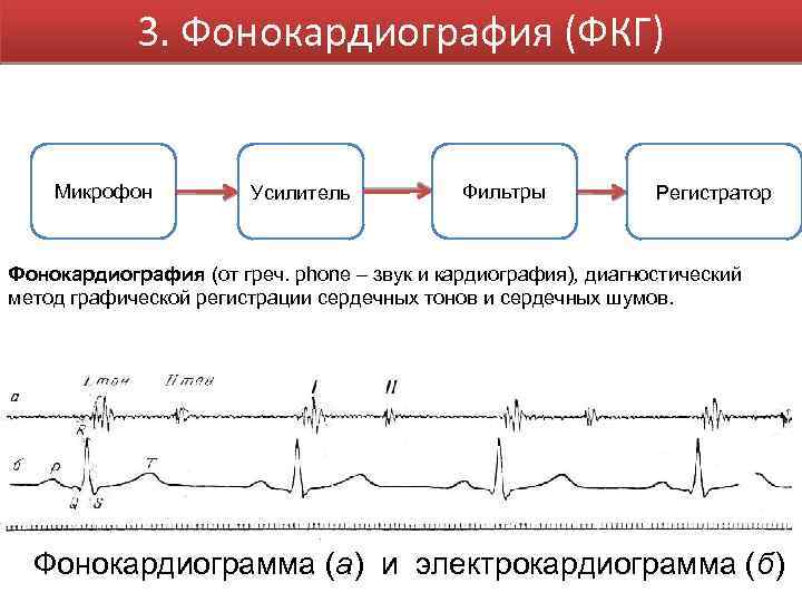 3. Фонокардиография (ФКГ) Микрофон Усилитель Фильтры Регистратор Фонокардиография (от греч. phone – звук и