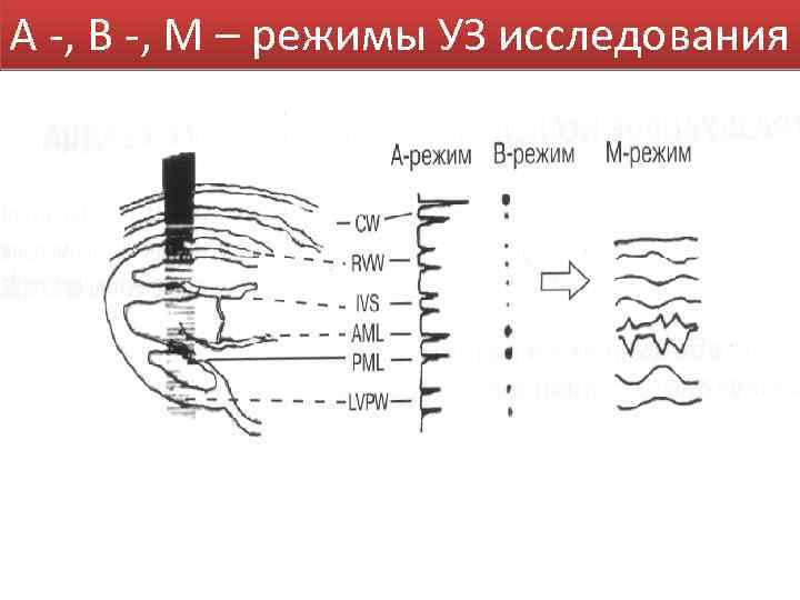 А -, В -, М – режимы УЗ исследования 