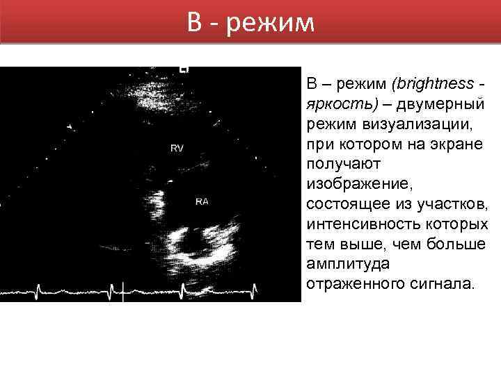 В - режим В – режим (brightness яркость) – двумерный режим визуализации, при котором