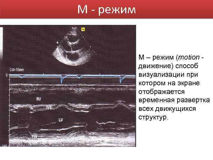 М - режим М – режим (motion - движение) способ визуализации при котором на