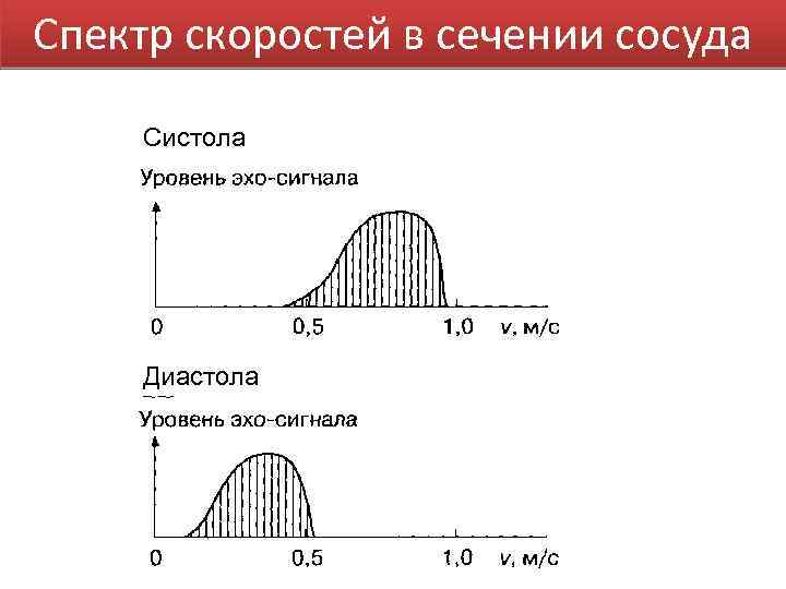 Спектр скоростей в сечении сосуда Систола Диастола 