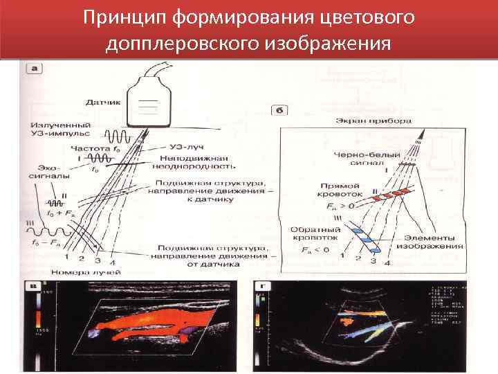 Принцип формирования цветового допплеровского изображения 