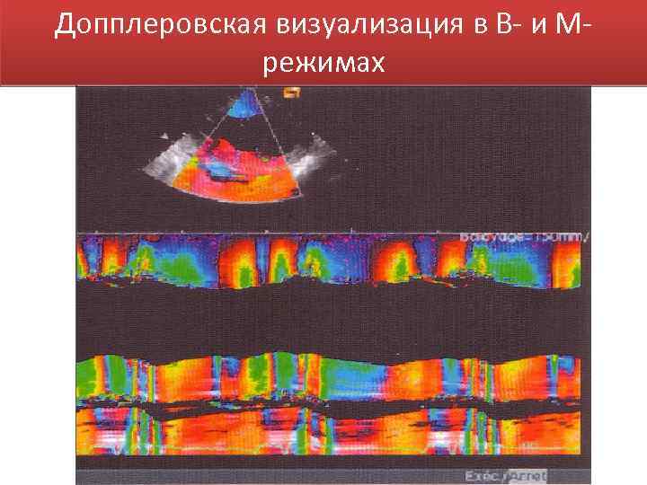 Допплеровская визуализация в В- и Мрежимах 