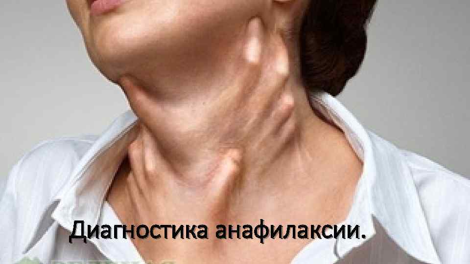 Диагностика анафилаксии. 