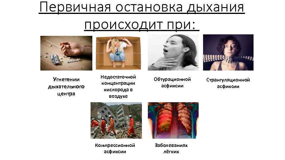 Первичная остановка дыхания происходит при: Угнетении дыхательного центра Недостаточной концентрации кислорода в воздухе Компрессионной