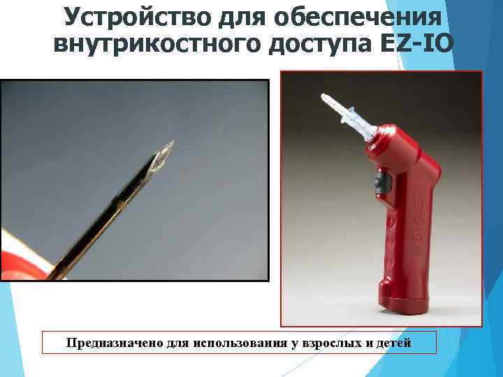 Устройство для обеспечения внутрикостного доступа EZ-IO Предназначено для использования у взрослых и детей 