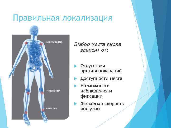Правильная локализация Выбор места вкола зависит от: Отсутствия противопоказаний Доступности места Возможности наблюдения и