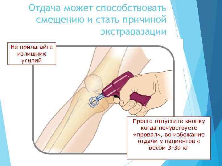 Отдача может способствовать смещению и стать причиной экстравазации Не прилагайте излишних усилий Просто отпустите