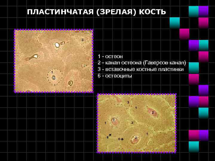 ПЛАСТИНЧАТАЯ (ЗРЕЛАЯ) КОСТЬ 1 - остеон 2 - канал остеона (Гаверсов канал) 3 -