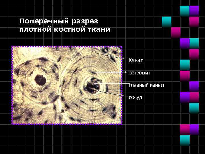 Поперечный разрез плотной костной ткани Канал остеоцит главный канал сосуд 