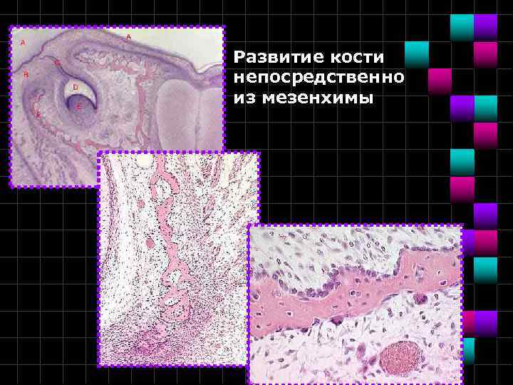 Развитие кости непосредственно из мезенхимы 